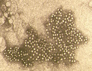 Electron microscopy image of negatively stained parvovirus particles (X25,000 magnification).